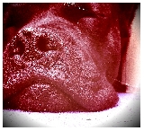 TENGO ALGO EN LA NARIZ